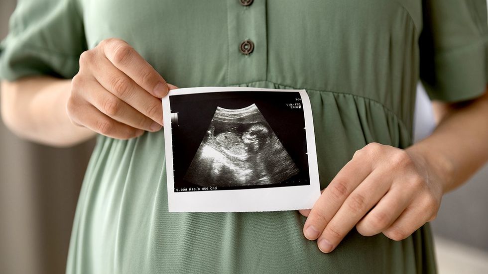 pregnant person holding ultrasound picture