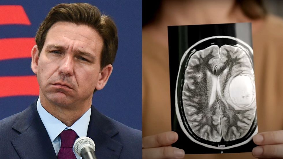 ron desantis woman in abortion commercial holding a brain scan showing a large tumor