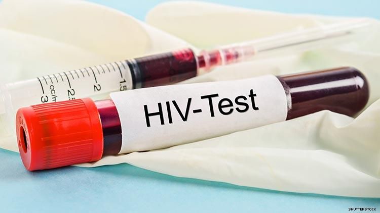 HIV Test