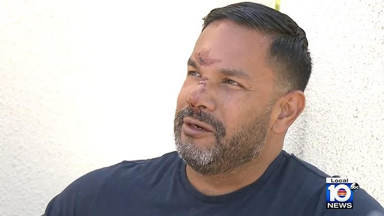 Gay Man Brutally Punched By Stranger in Frightening Florida Attack